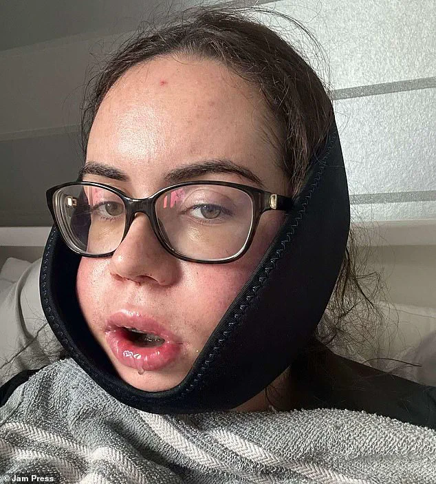From Shame to Confidence: How a Severe Underbite Shaped a Woman's Journey and Highlighted Community Perceptions of Physical Appearance