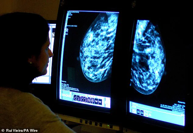 Breast Cancer Surgeon Issues Urgent Warning: Four Brutal Truths About Early Detection and Rising Rates That Every Woman Needs to Know Now