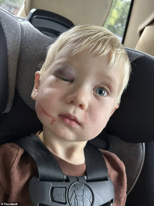 Judge's Controversial Bail Decision Sparks Outrage Over Daycare Worker's Alleged Child Abuse