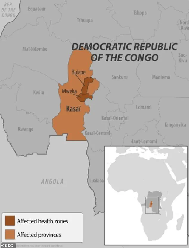 Health Officials Confirm New Ebola Outbreak in DRC: 20 Dead, 58 Suspected Cases Under Investigation in Kasai Province