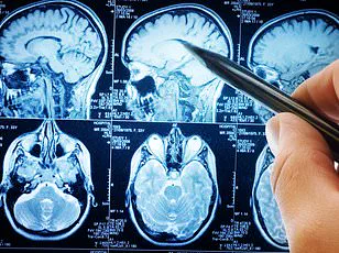 XR Glasses for Dementia: Innovating with Limited Access and Data Privacy Challenges
