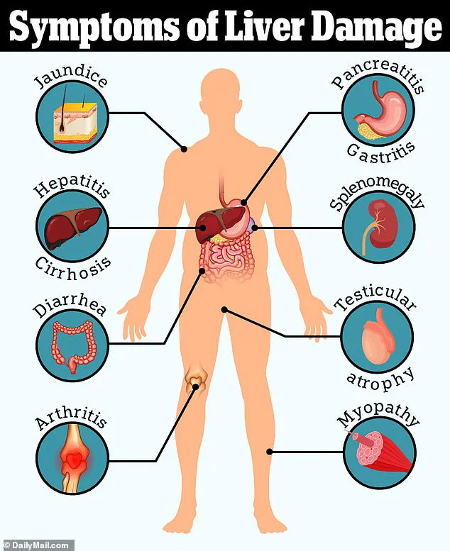 Silent Epidemic: 80-100 Million Americans May Have Undiagnosed Fatty Liver Disease, Says Dr. Jane Smith, Hepatology Expert