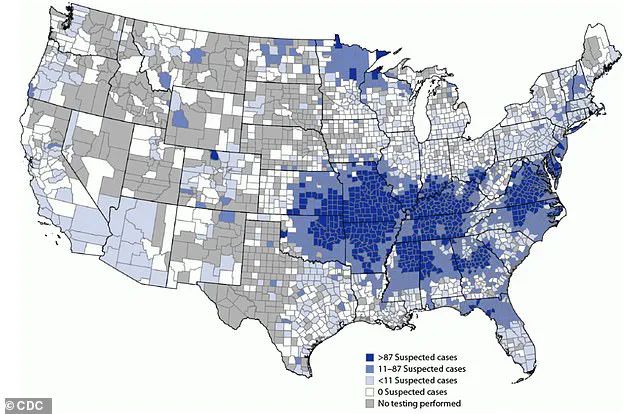 Emerging Health Threat: First Fatality Linked to Alpha-Gal Syndrome Highlights Growing Risk of Tick-Bite-Induced Meat Allergy