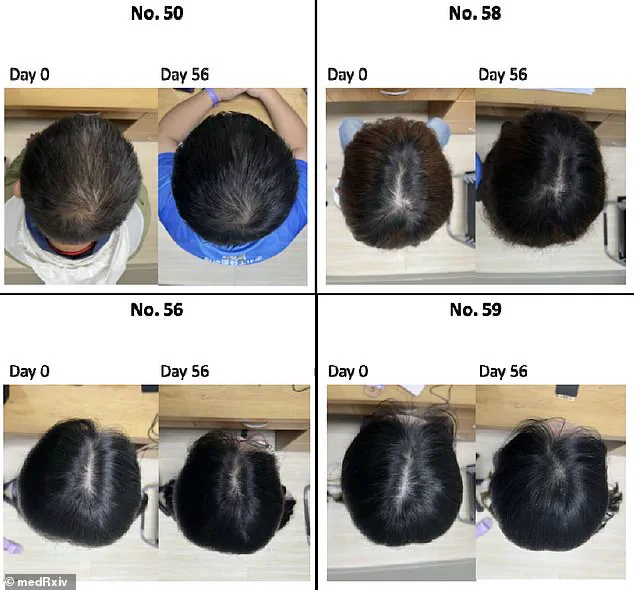 Breakthrough in Hair Regrowth: Centella asiatica-Based Serum Combines Natural and Lab-Engineered Proteins in Promising Study