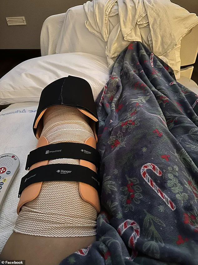 Urgent Pet Safety Questions After Tennessee Mother's Amputation in Shocking Dog Attack