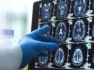 Urgent Insights: New Study Reveals Lifestyle's Critical Role in Dementia Surge, as Cases Set to Double in 25 Years
