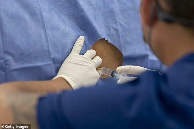 Breakthrough Gel Shows Promise in Halving Chronic Back Pain