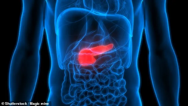 Groundbreaking Study Uncovers Potential Link Between Type 2 Diabetes and Pancreatic Cancer Risk