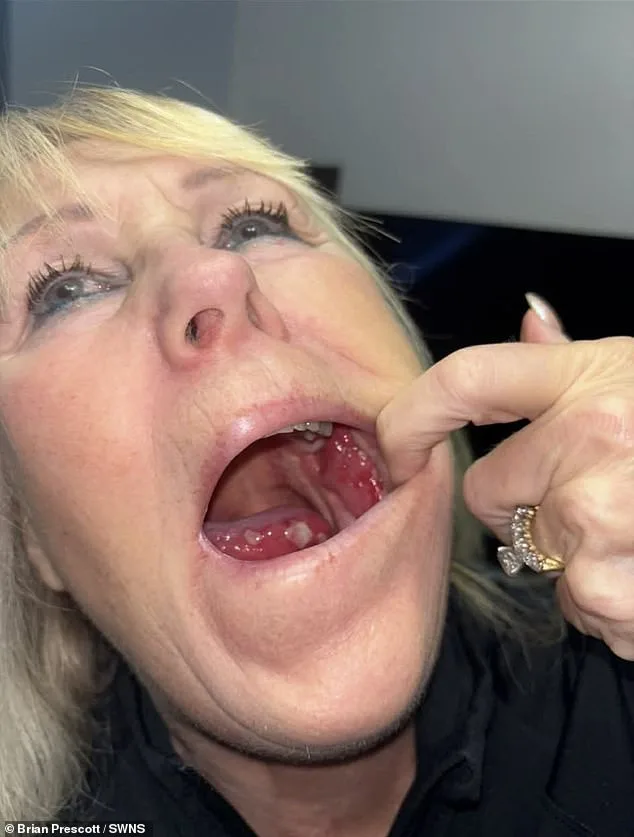 Silent Signs: Margot Blair's Tongue Cancer Journey and Overlooked Symptoms