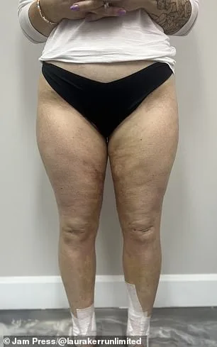 Laura Kerr's Unexplained Weight Gain and the Medical Dismissal That Shaped Her Perimenopause Journey