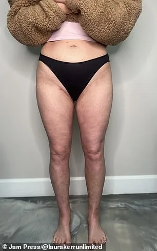Laura Kerr's Unexplained Weight Gain and the Medical Dismissal That Shaped Her Perimenopause Journey