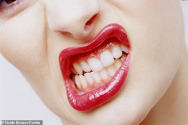 Bruxism: A Common Yet Overlooked Condition with Serious Consequences