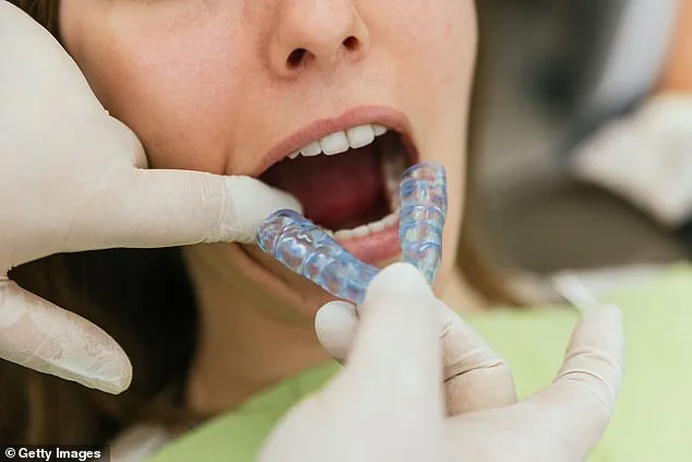 Bruxism: A Common Yet Overlooked Condition with Serious Consequences