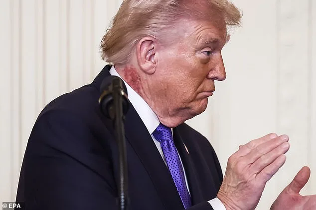 Trump's Mysterious Rash Sparks Health Speculation Despite Doctor's Statement