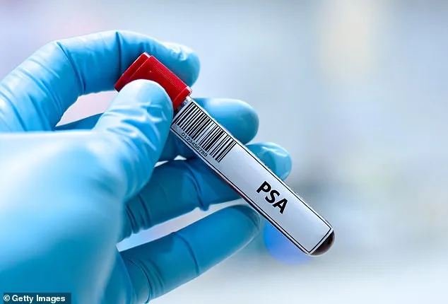 Groundbreaking Discovery: Diabetes Drug Metformin Could Cut Prostate Cancer Risk by Over One-Third at Just 2p Per Tablet