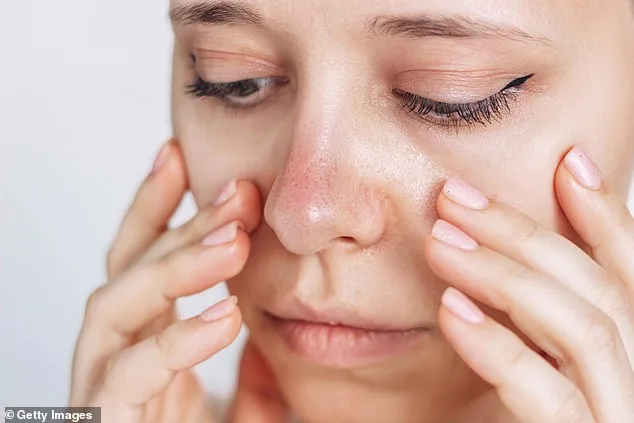 Unraveling an Atypical Raynaud's Mystery: Persistent Nasal Coldness Baffles Doctors