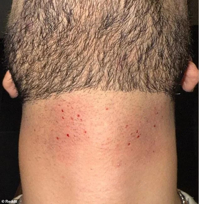 Single-Blade Razors Resurge, But Pose Hidden Risks of Cuts and Irritation