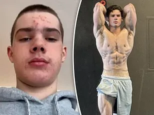 Clavicular (Braden Peters) Arrested in Florida on Misdemeanor Assault Charges Involving Livestream Fight