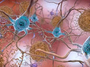 Antidepressant Shows Promise in Alleviating Long Covid Fatigue, Study Finds