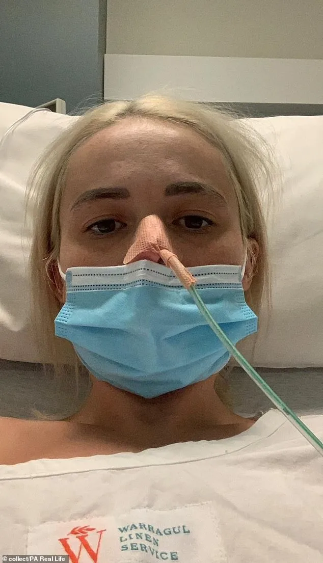 A Young Woman's Hidden Battle: The Two-Year Struggle with Bowel Cancer That Went Undiagnosed