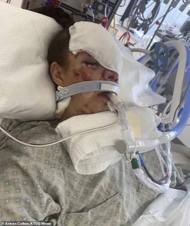 Kenai resident breaks silence on life-altering injuries from bear mauling.