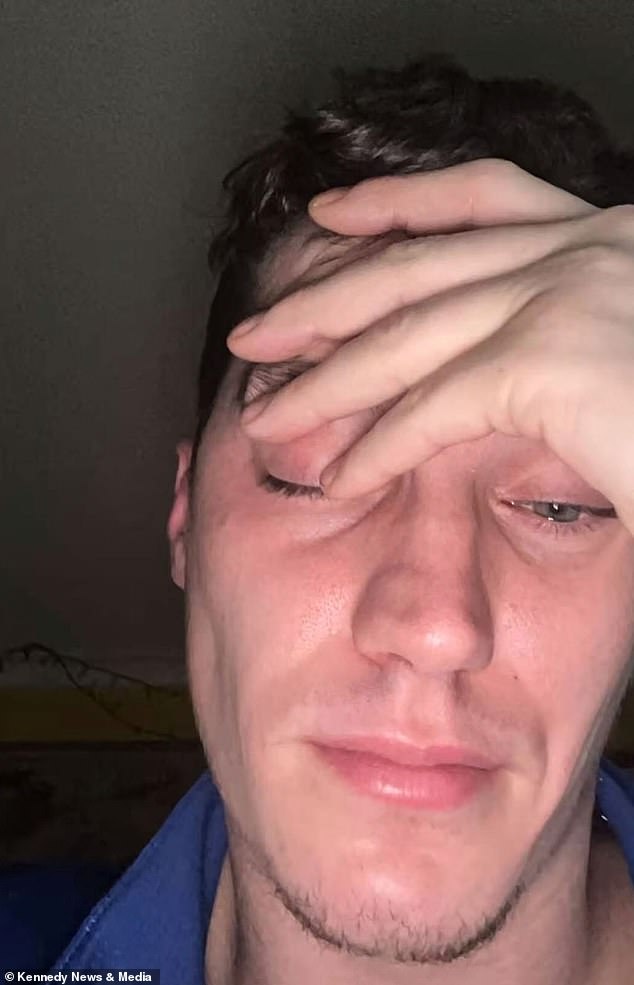 Bradley Robinson reveals permanent facial disfigurement after 15 years of cocaine addiction.